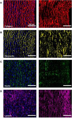 Decellularization of Porcine Carotid Arteries: From the Vessel to the High-Quality Scaffold in Five Hours